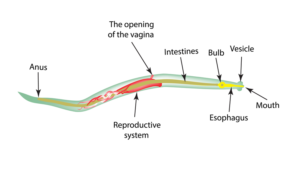 how to get rid of pinworms overnight naturally