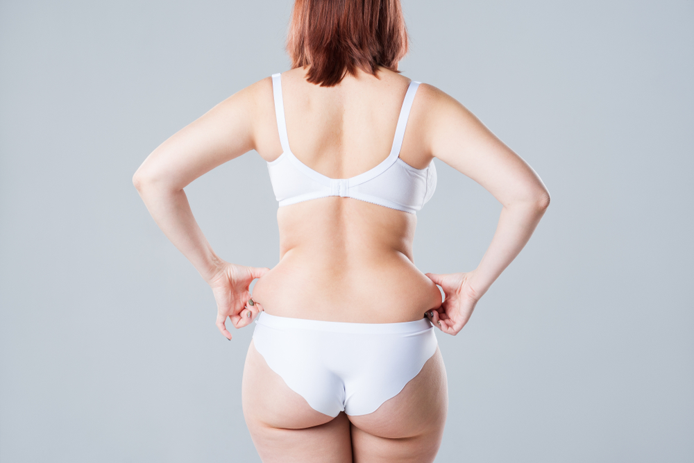 Back Liposuction