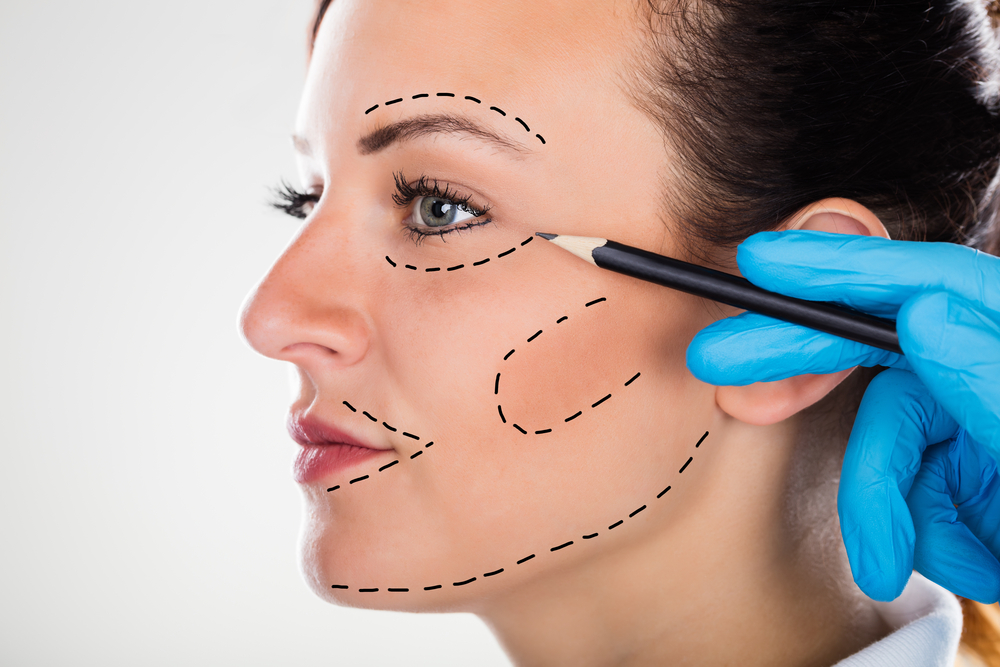 Face Liposuction