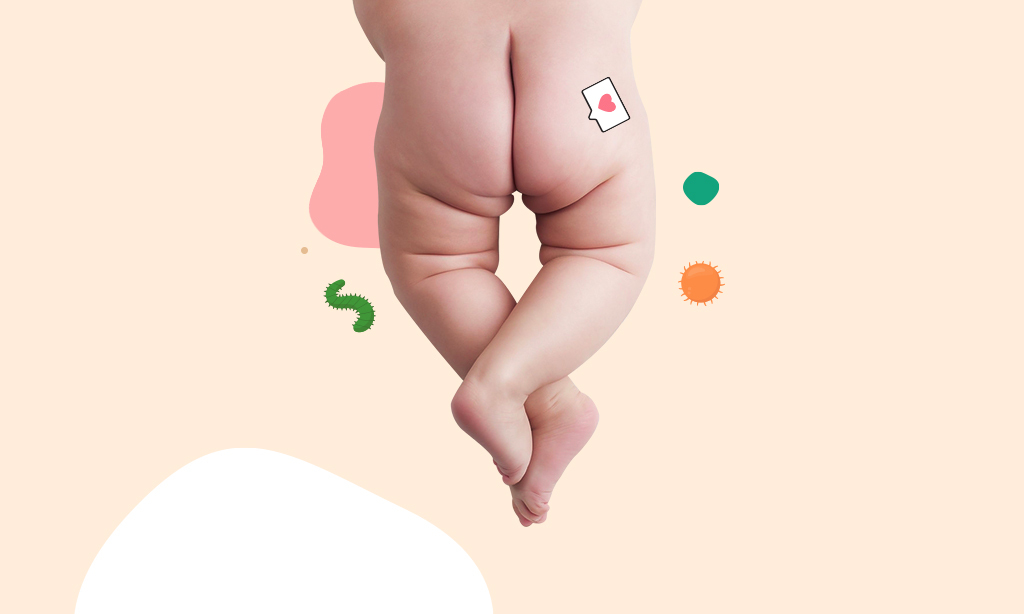 Boils On Toddler’s Bottom – Causes, Symptoms And Its Remedies