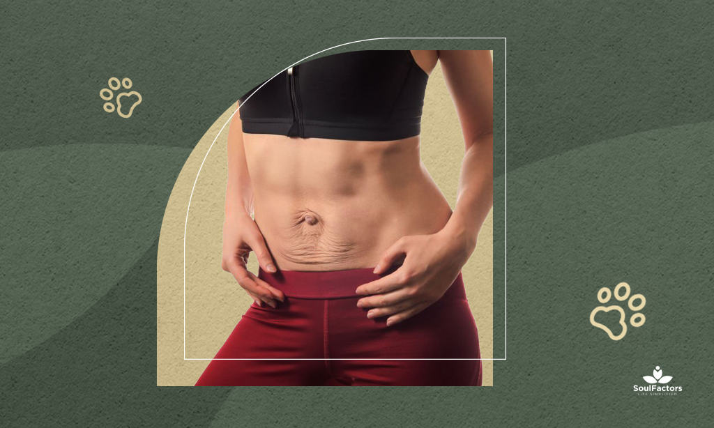 feature -How To Get Rid Of Diastasis Recti Years Later