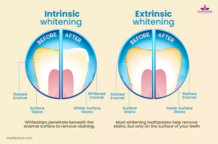 Intrinsic Whitening And Extrinsic Whitening