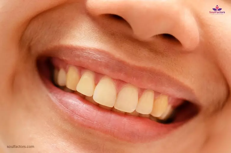 Teeth Whitening Treatments: Are Yellow Teeth A Sign Of Unhealthy Teeth?