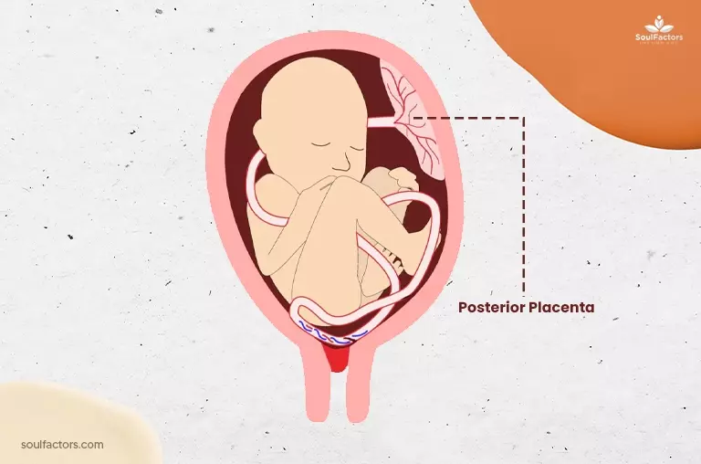 Posterior placenta means boy or girl