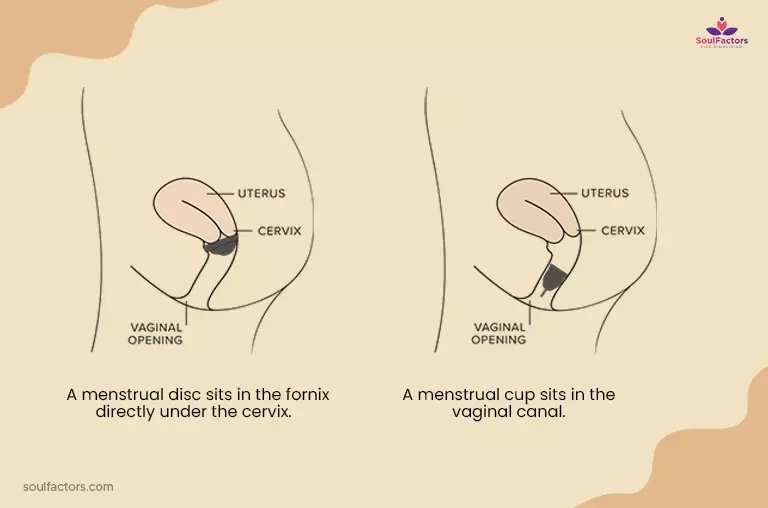 Menstrual Disc vs Menstrual Cup: Insertions 