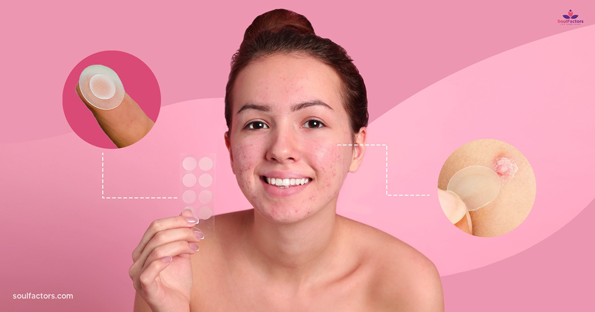 How Do Pimple Patches Work? Are They Making Acne Worse?