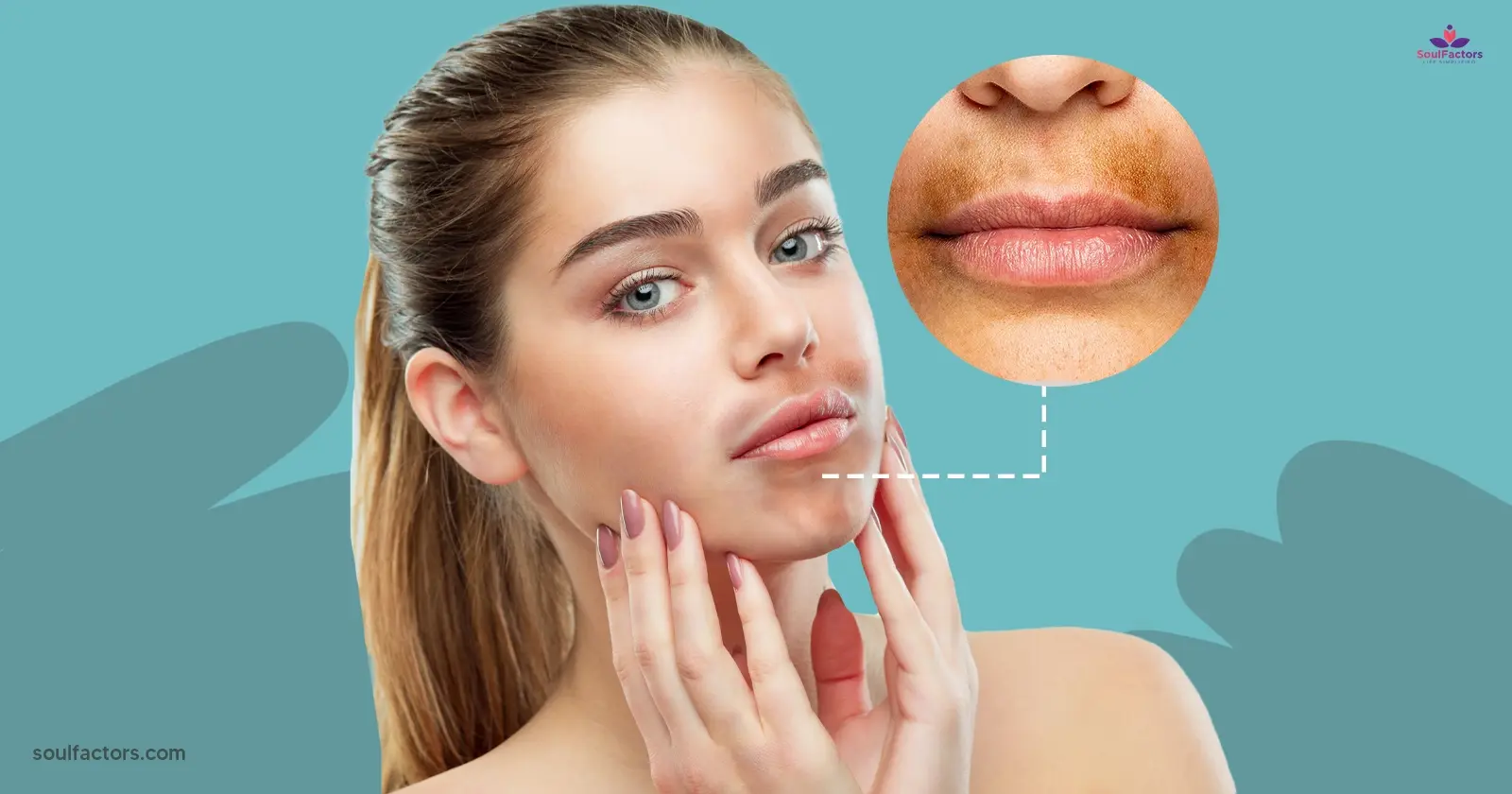 Kisser Woes How to get rid of hyperpigmentation around the mouth once and for all - feature