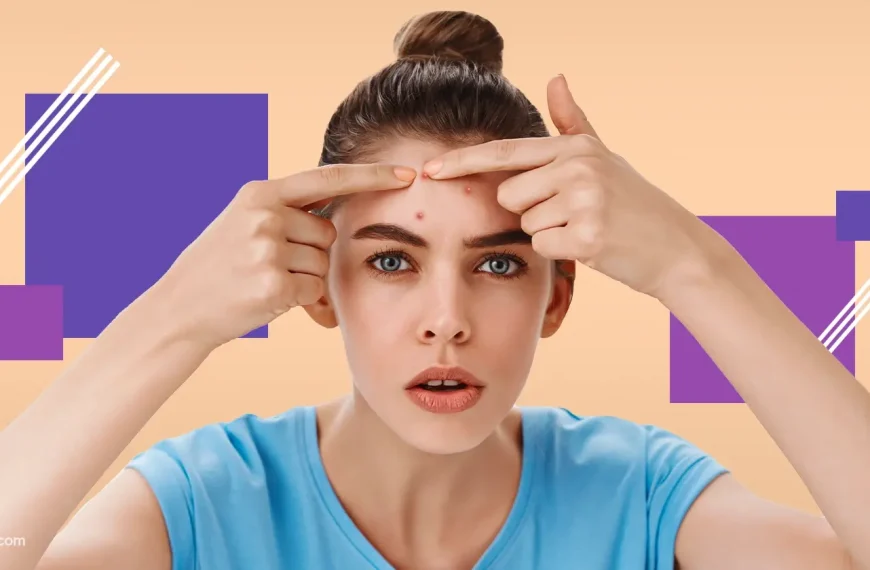 The Best Formula to Triumph Forehead Acne - Feature