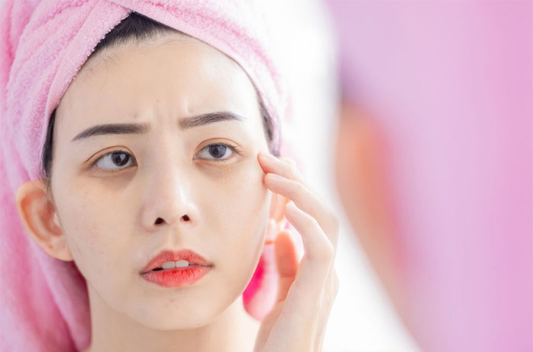 What Deficiency Causes Dark Circles? Are Dark Circles Under Eyes A Sign Of Illness?