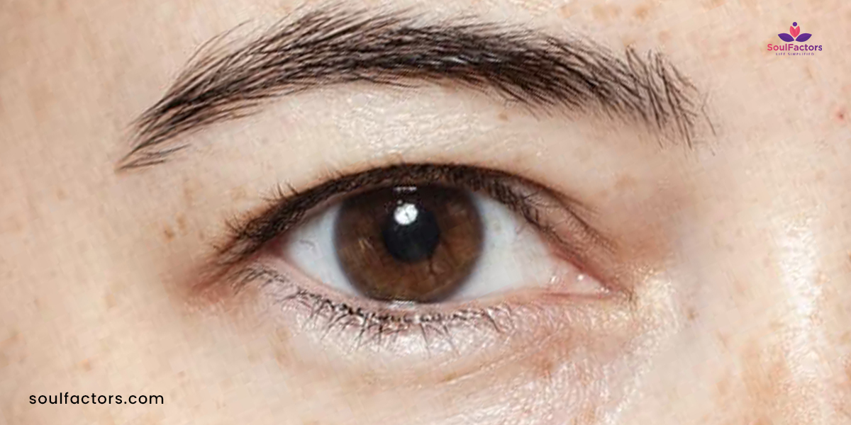 types of eyelids hooded