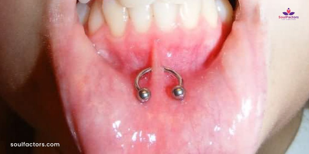 Frenulum Piercing Procedure, Aftercare & Unique Style Statement!