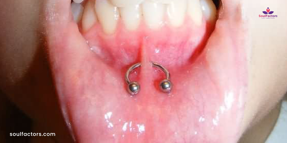 Lower Lip Frenulum Piercing