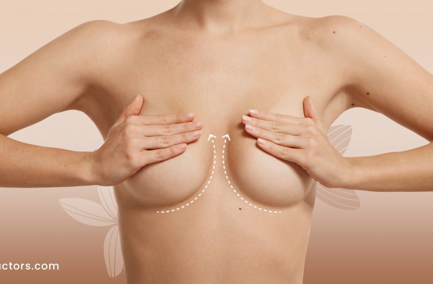 Spare The Knife & Bare The Confidence-  All About Nonsurgical Breast Lifts!