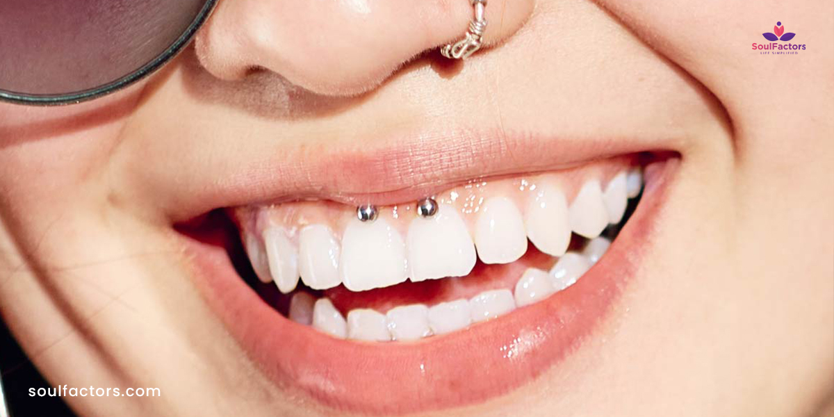 Upper Lip /Smiley Piercing