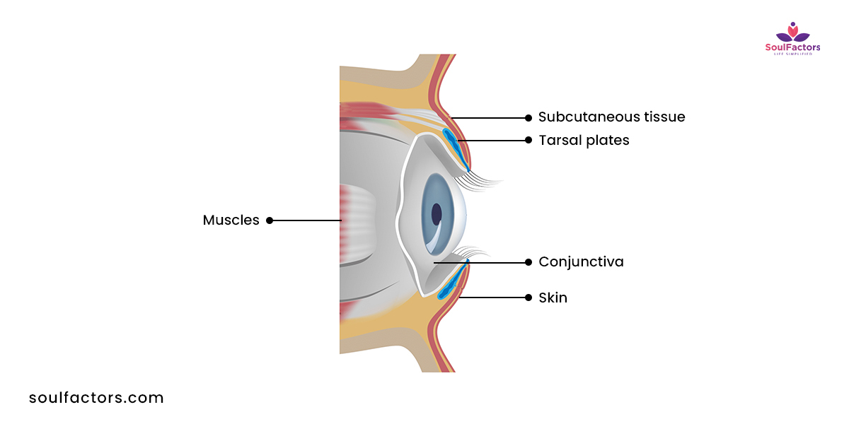 Types Of Eyelids With Pictures