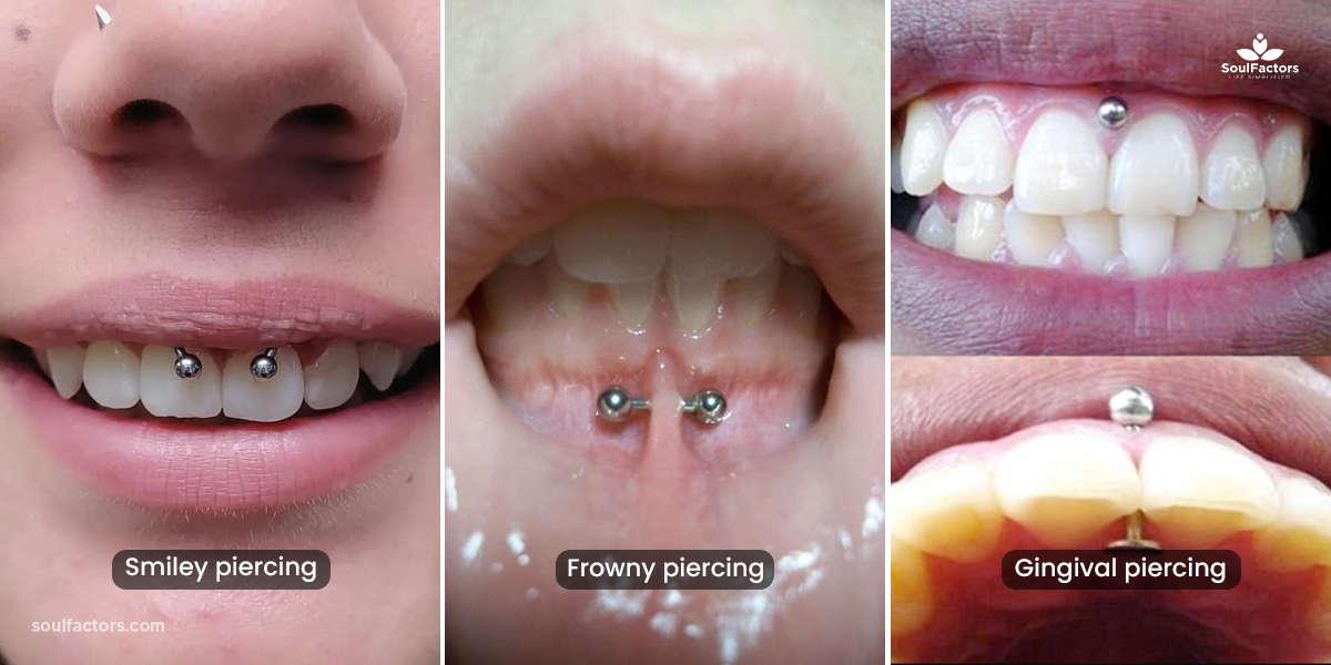 What Is Gum Piercing?
