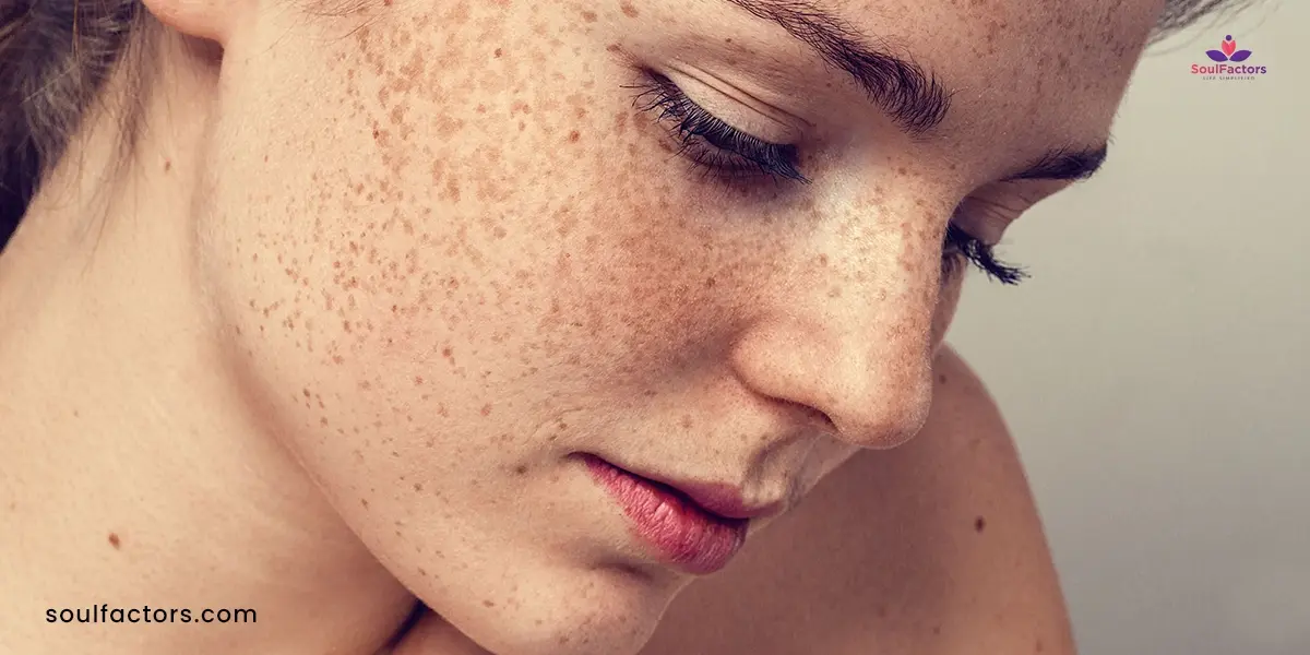 Common Causes Of Textured Skin