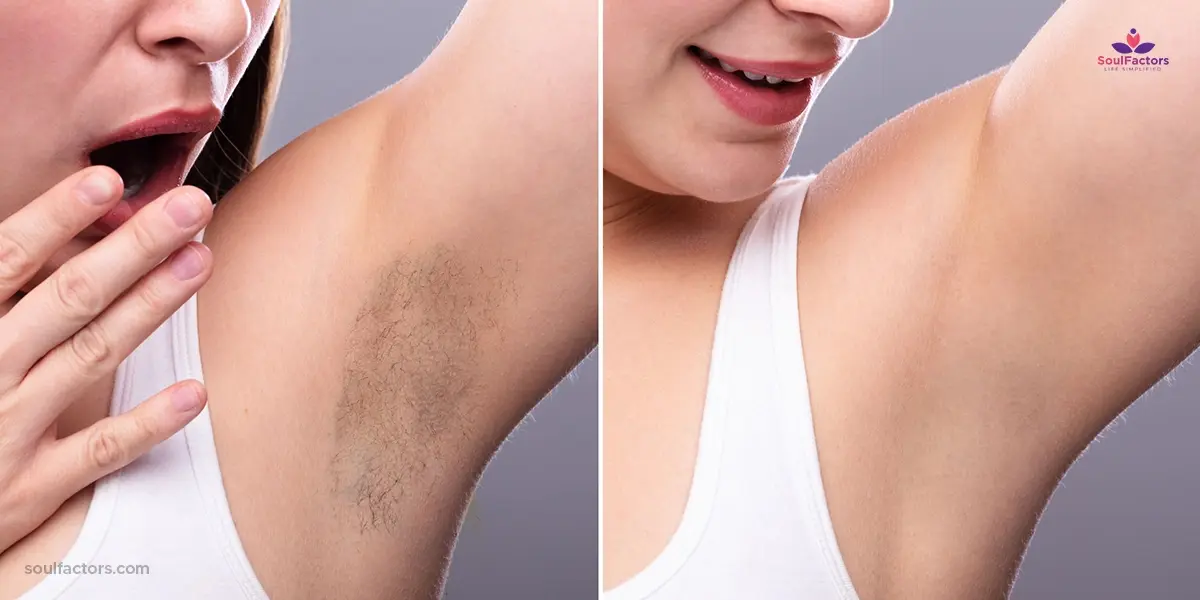 waxing vs shaving