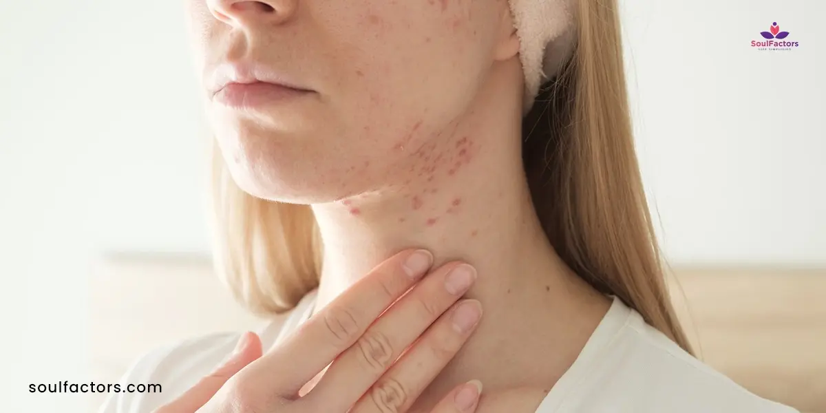 pimples on neck