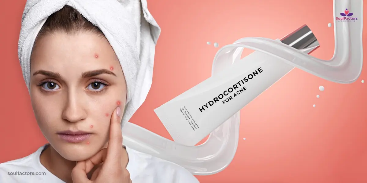 Hydrocortisone Cream For Acne