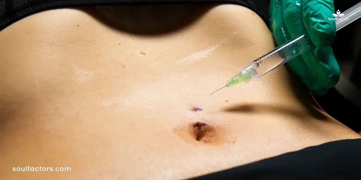 Belly Button Piercing Infection Pictures