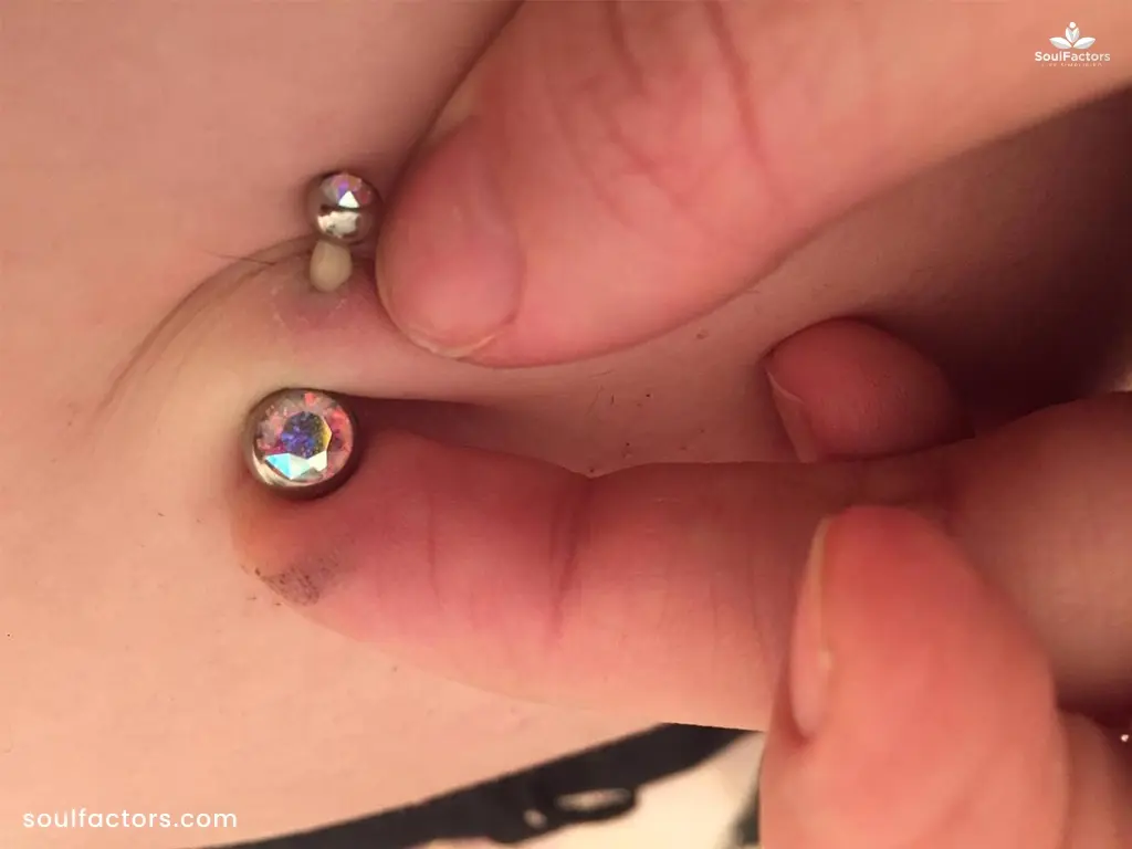 Belly Button Piercing Infection Symptoms 