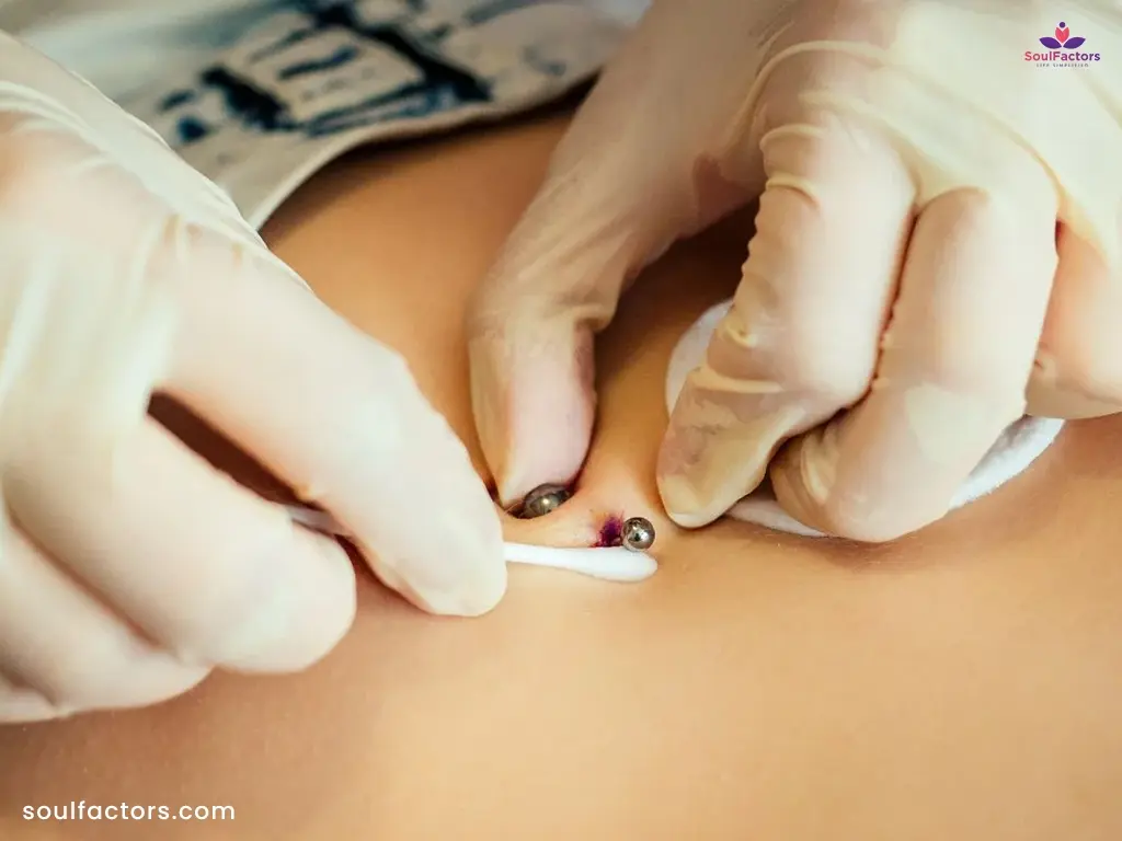Belly Button Piercing Infection Treatment