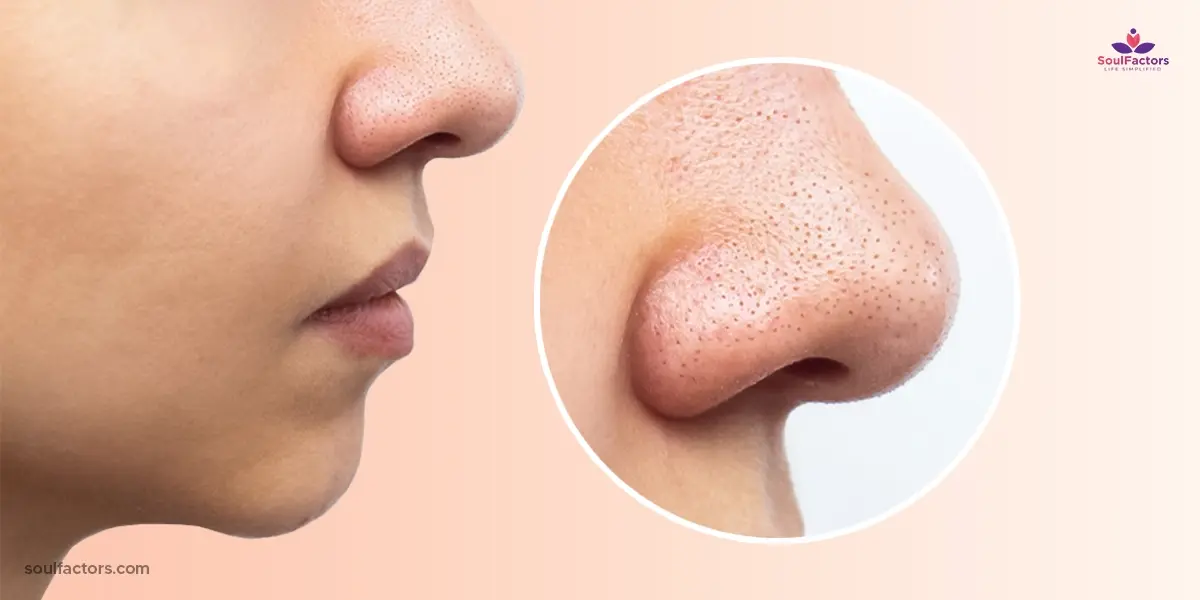 How To Shrink Pores On Nose
