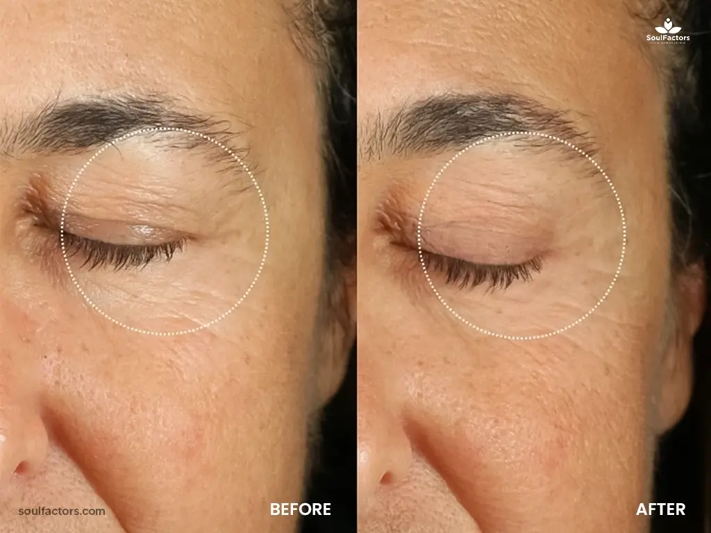 One Skin Eye Cream Before and After
