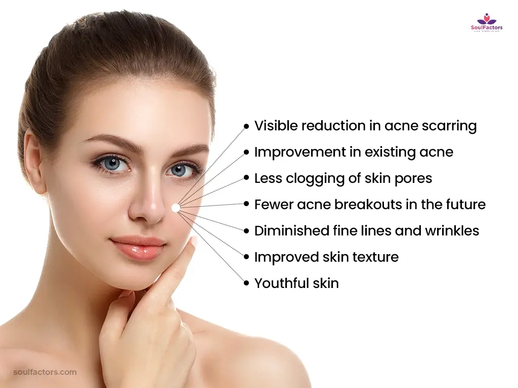 Tretinoin Acne Scars Before & After