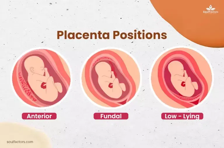 Posterior placenta normal delivery