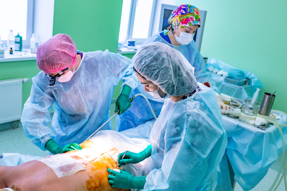 Surgical Liposuction procedures