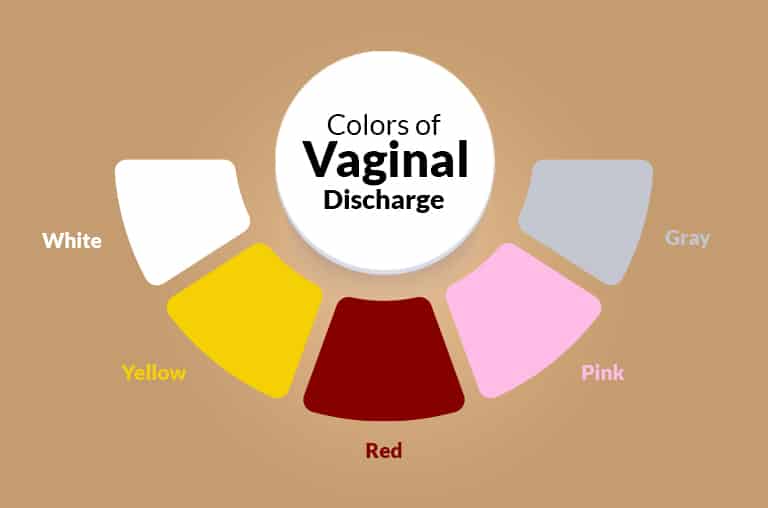 Kinds Of Vaginal Discharge