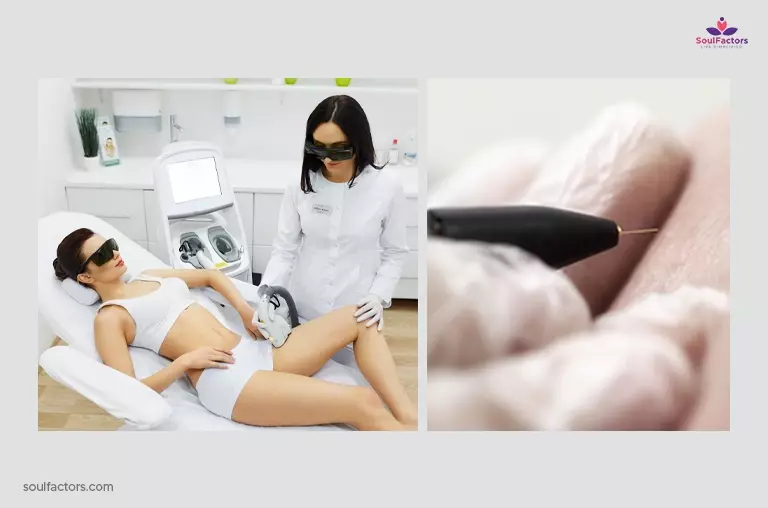 What Are The Medical Hair Removal Methods?